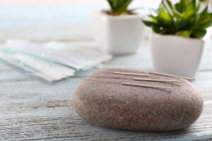 acupuncture menopause benefits