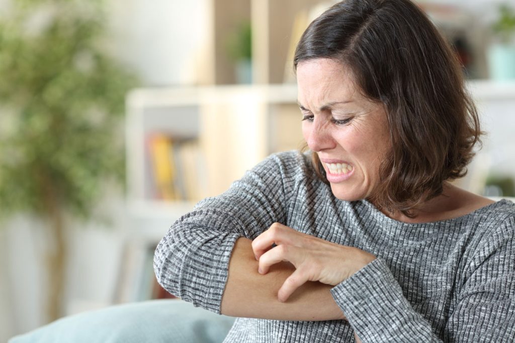 middle aged woman with dry itchy skin