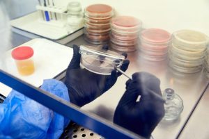 urine lab test for someone with frequent UTI