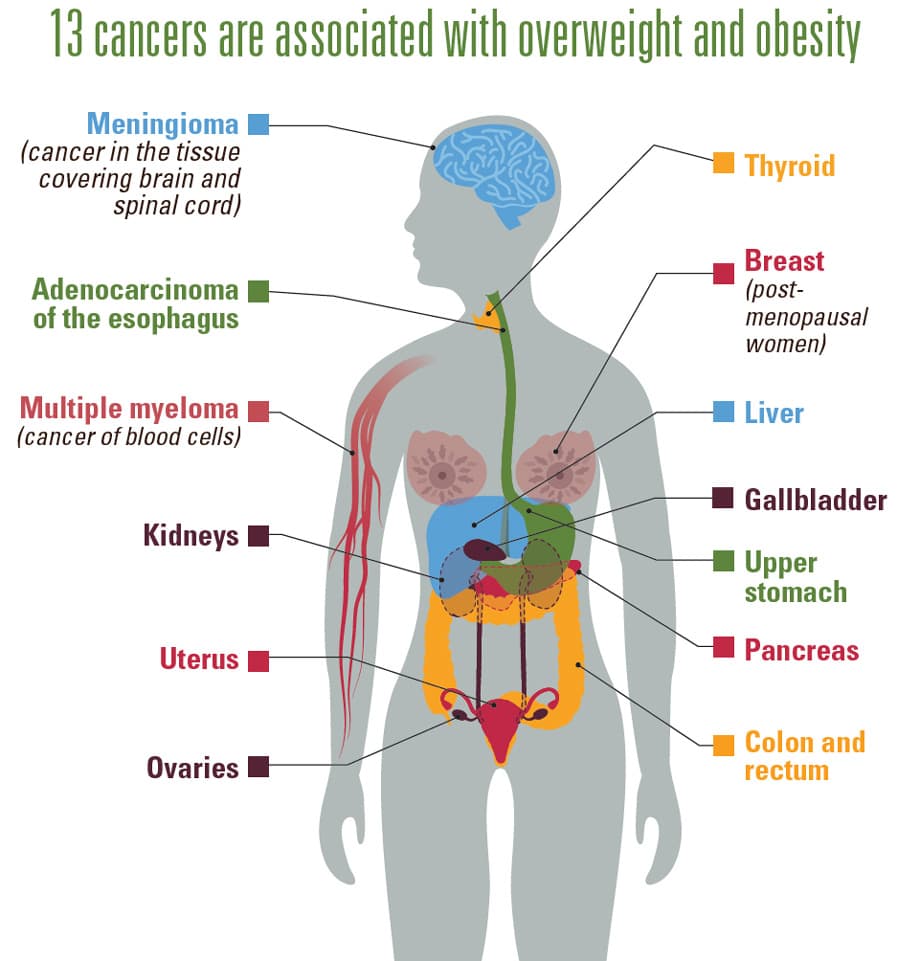 CDC graphic showing cancers associated with being overweight and obese