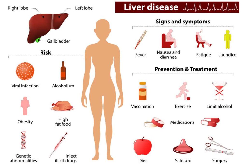 Liver disease infographic with signs symptoms and treatment